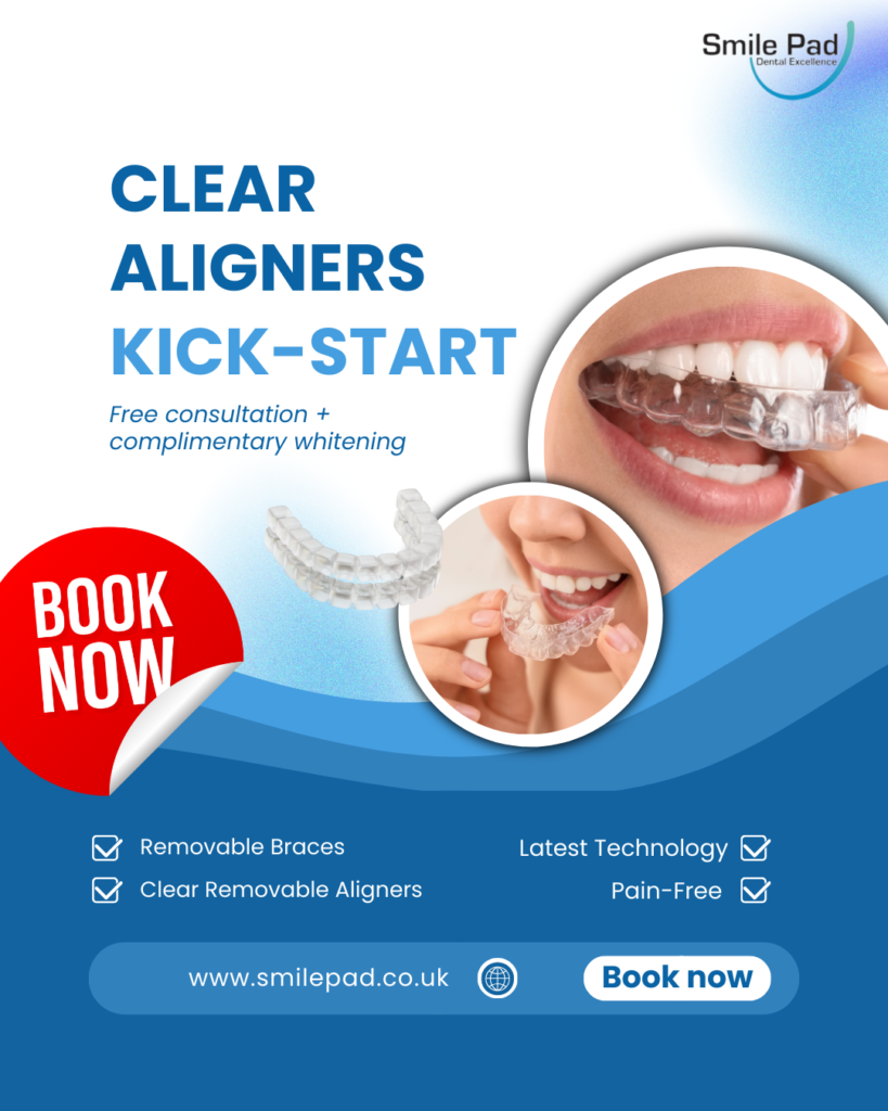 Clear Aligners
