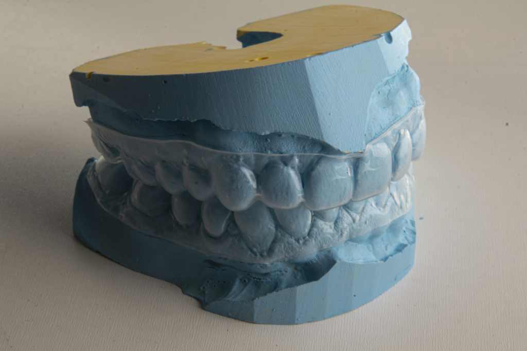 clear aligners