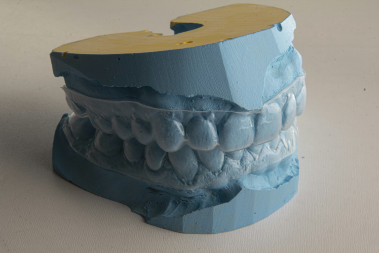 clear aligners