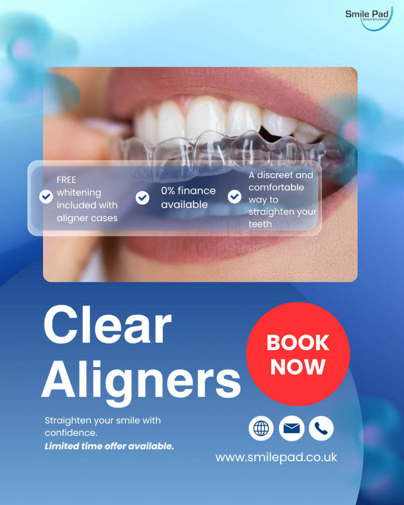 Clear Aligners